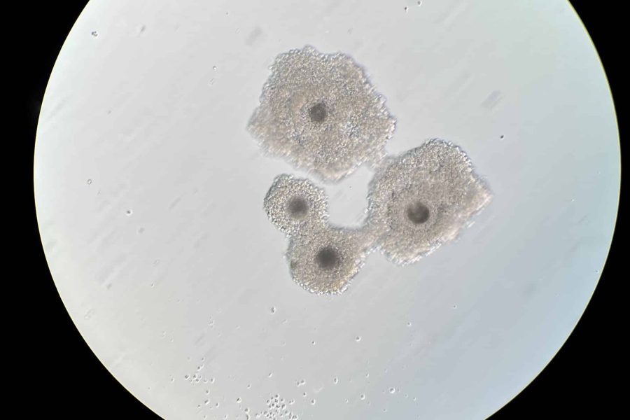 5.1 icsi - oocitos resultados esperados